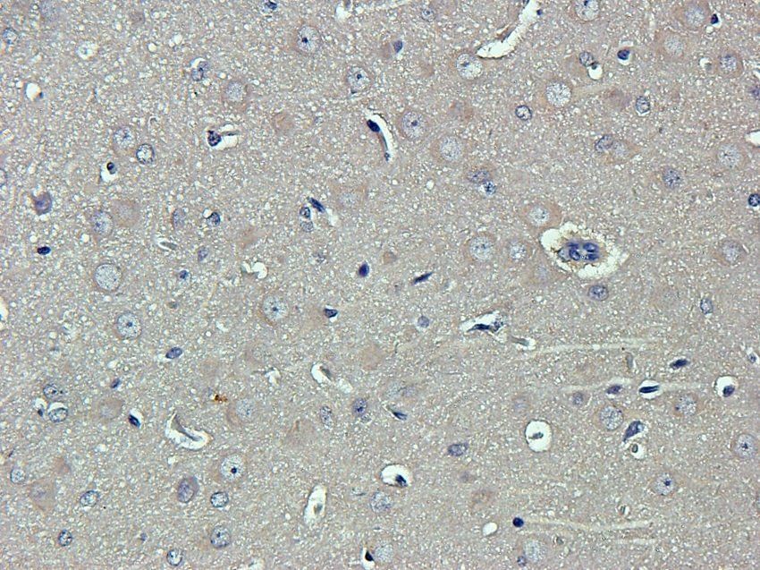 TYRP1 antibody