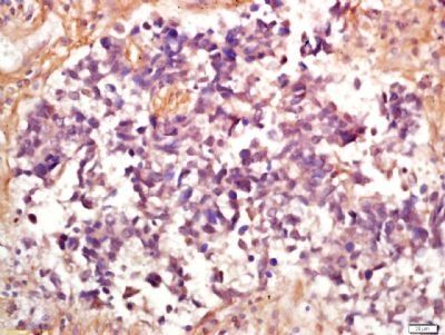 Phospho-eIF4EBP1 (Ser65 + Thr70) Rabbit Polyclonal Antibody