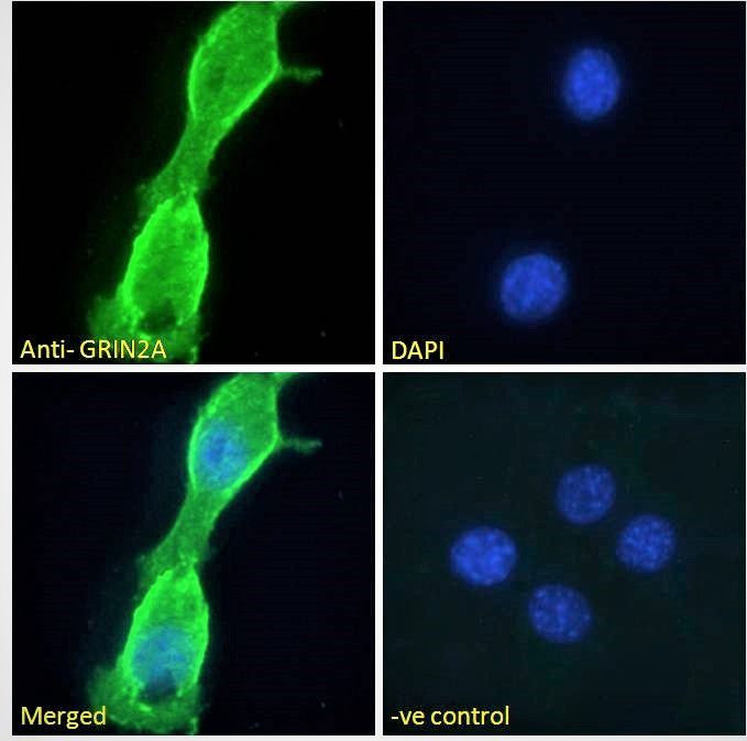 GRIN2A (aa211-224) Antibody