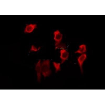 CD3 zeta Antibody