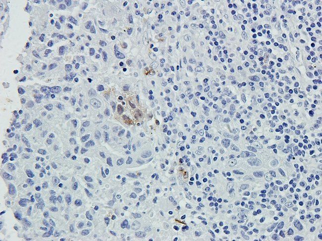 5-HT2B Receptor Rabbit Polyclonal Antibody