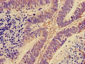 RPL28 Antibody (Biotin)