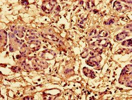 RPL28 Antibody