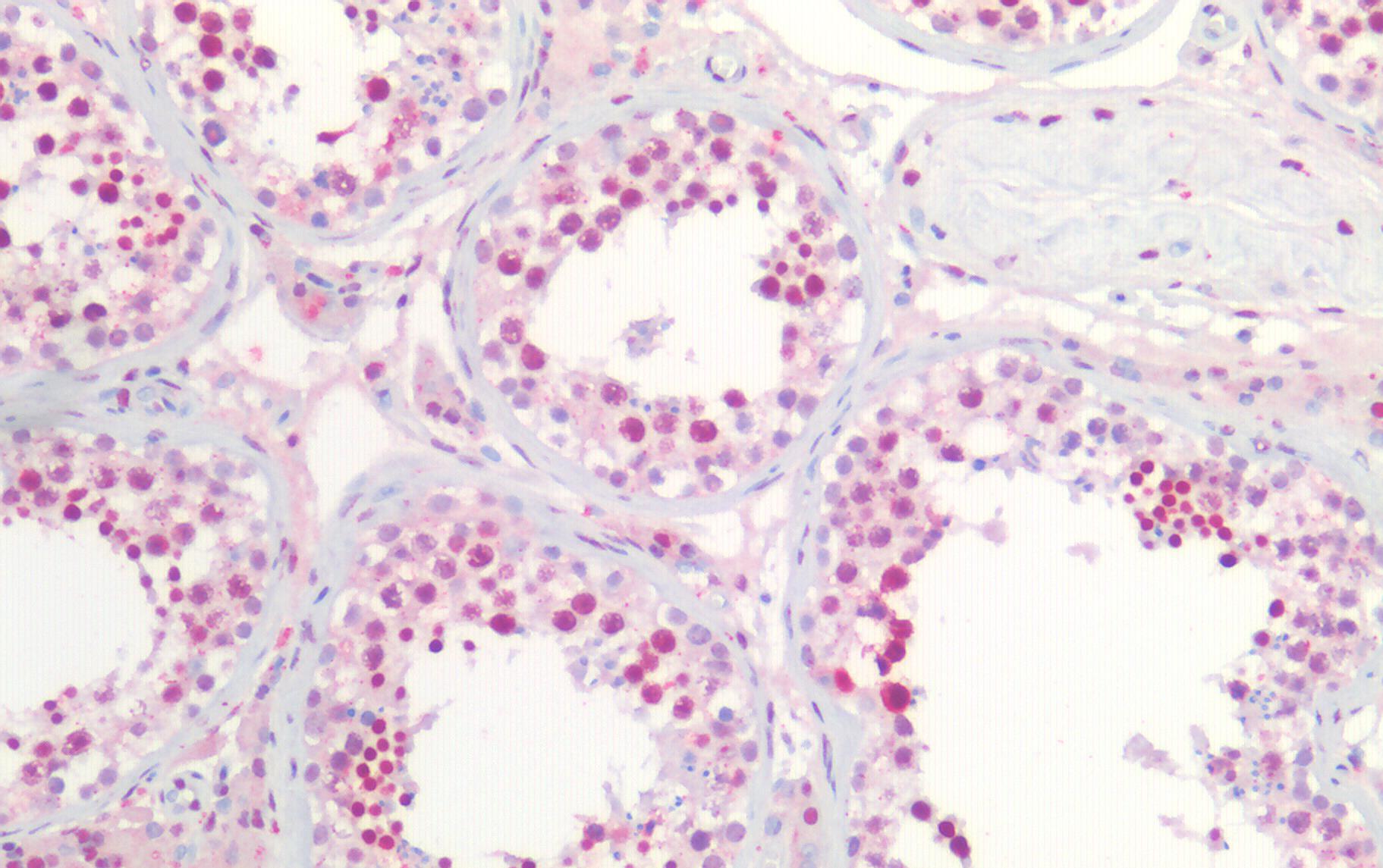 Nucleophosmin/NPM1 Antibody