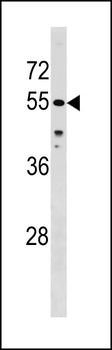 CHEK1 Antibody (Center S296)