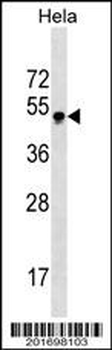 GBX2 Antibody (Center)