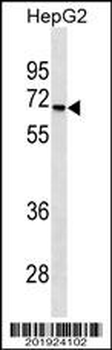 STK39 Antibody