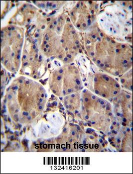 LIMD1 Antibody (C-term)