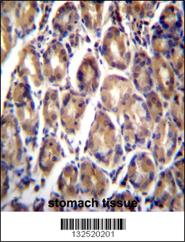 RARRES1 Antibody (C-term)