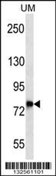 DNAJC14 Antibody (Center)