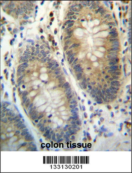 TEX261 Antibody (C-term)