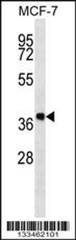 DHRS7B Antibody (Center)