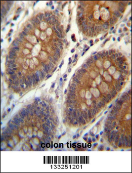 TRIM38 Antibody (C-term)
