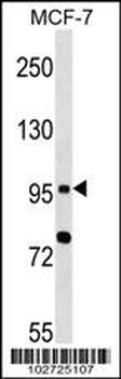 Mouse TLR6 Antibody (N-term)