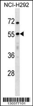 USP27X Antibody (N-term)