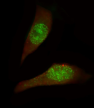 USP27X Antibody (N-term)