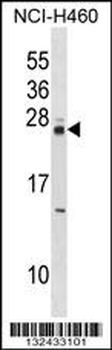 MOBKL3 Antibody (N-term)