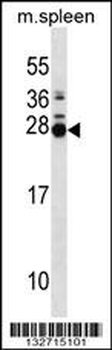 MOL2B Antibody (N-term)