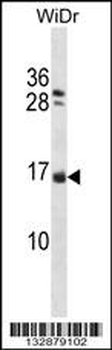NHLH1 Antibody (Center)