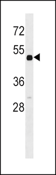 RARB Antibody (N-term)
