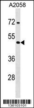 TPRX1 Antibody (N-term)