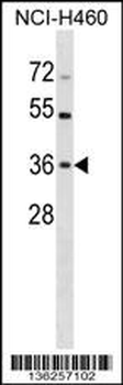 HUS1 Antibody (C-term)