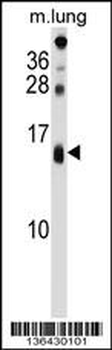 DEXI Antibody (C-term)