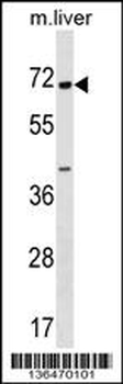 CPNE6 Antibody (N-term)