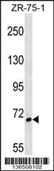 SH3BP1 Antibody (Center)