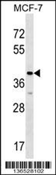 MRPL1 Antibody (N-term)