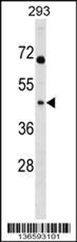 MRPL39 Antibody (C-term)