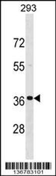 TNNT3 Antibody (C-term)