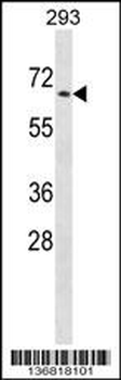 PTPN5 Antibody (N-term)