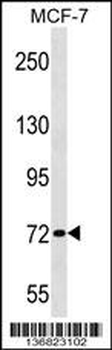 ZNF408 Antibody (Center)
