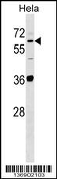 SUOX Antibody (Center)