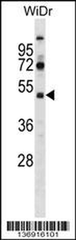 SUPT7L Antibody (Center)