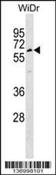 TULP1 Antibody (Center)