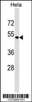 KRR1 Antibody (N-term)