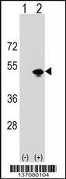 KRR1 Antibody (N-term)