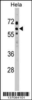 SOCS7 Antibody (C-term)