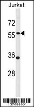 PANX1 Antibody (Center)