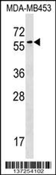 FSD1 Antibody (N-term)