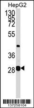 GLYCTK Antibody (N-term)