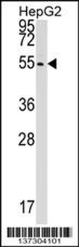 CLP1 Antibody (C-term)