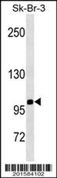 SPN/CD43 Antibody (N-term)