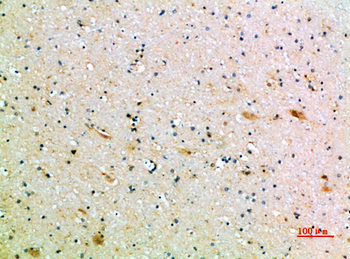 CD1B Polyclonal Antibody