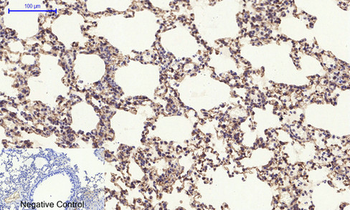 Tau Polyclonal Antibody