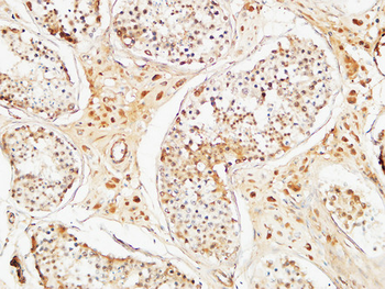 ALB Polyclonal Antibody