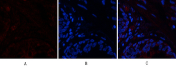 PTEN Polyclonal Antibody