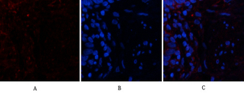 PTEN Polyclonal Antibody